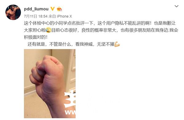 沈灵敏透露PDD近况：会回来直播 病情已确认为良性