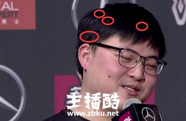RNG战胜RW后，赛后采访中Uzi的白发令玩家动容，网友：天道酬勤！